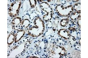 Immunohistochemical staining of paraffin-embedded Kidney tissue using anti-PLEK mouse monoclonal antibody. (Pleckstrin anticorps)