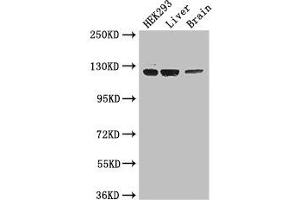 Western Blot Positive WB detected in: HEK293 whole cell lysate, Mouse liver tissue, Mouse brain tissue All lanes: GUCY2C antibody at 3. (GUCY2C anticorps  (AA 636-891))