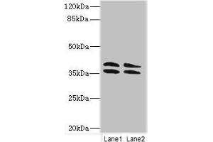 Western blot All lanes: CA10 antibody at 4 μg/mL Lane 1: HL60 whole cell lysate Lane 2: Mouse brain tissue Secondary Goat polyclonal to rabbit IgG at 1/10000 dilution Predicted band size: 38, 30 kDa Observed band size: 38 kDa (CA1 anticorps  (AA 61-320))