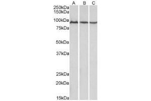 AP21267PU-N ACO2 Antibody staining of Mouse (A), Rat (B) and Pig (C) Skeletal Muscle lysates at 0. (ACO2 anticorps  (Internal Region))