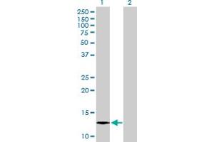 Western Blot analysis of C1orf38 expression in transfected 293T cell line by C1orf38 MaxPab polyclonal antibody. (C1orf38 anticorps  (AA 1-132))