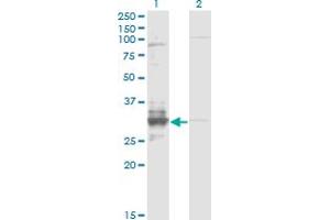 Western Blotting (WB) image for anti-Tissue Factor Pathway Inhibitor 2 (TFPI2) (AA 1-236) antibody (ABIN599020) (TFPI2 anticorps  (AA 1-236))