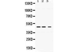 Western blot analysis of Perilipin 3 expression in rat liver extract ( Lane 1), mouse kidney extract ( Lane 2) and HELA whole cell lysates ( Lane 3). (PLIN3 anticorps  (C-Term))