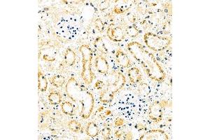 Immunohistochemistry of paraffin embedded mouse ischemic kidney using MUC20 (ABIN7074692) at dilution of 1:1000 (400x lens) (MUC20 anticorps)
