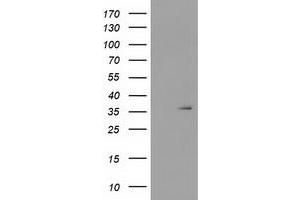 Image no. 1 for anti-Short Chain Dehydrogenase/reductase Family 9C, Member 7 (SDR9C7) antibody (ABIN1500848) (SDR9C7 anticorps)
