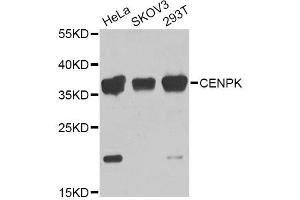 Western blot analysis of extracts of various cell lines, using CENPK Antibody (ABIN5975309) at 1/1000 dilution. (CENPK anticorps)