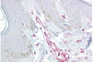 Anti-LIF antibody IHC staining of human skin. (LIF anticorps  (Internal Region))