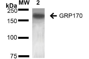 Western Blot analysis of Rat Liver showing detection of ~170 kDa GRP170 protein using Mouse Anti-GRP170 Monoclonal Antibody, Clone 6E3-2C3 (ABIN2868640).