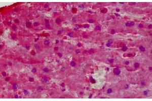 Human Liver: Formalin-Fixed, Paraffin-Embedded (FFPE)