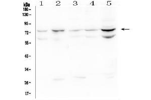 Western blot analysis of OLMF4 using anti-OLMF4 antibody (ABIN6719350). (Olfactomedin 4 anticorps  (AA 91-510))
