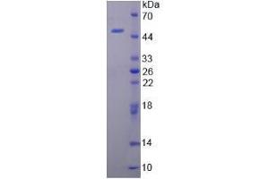 SDS-PAGE analysis of Mouse CAMP Protein. (Cathelicidin Antimicrobial Peptide (CAMP) Peptide)