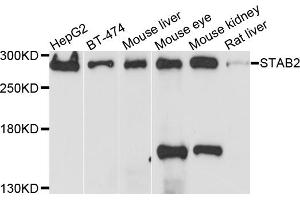 Western blot analysis of extracts of various cell lines, using STAB2 antibody. (Stabilin 2 (STAB2) anticorps)