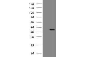 Image no. 1 for anti-Snail Family Zinc Finger 2 (SNAI2) antibody (ABIN1500987) (SLUG anticorps)