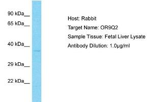 Host: Rabbit Target Name: OR9Q2 Sample Type: Fetal Liver lysates Antibody Dilution: 1. (OR9Q2 anticorps  (C-Term))