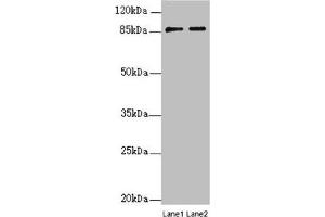 Western blot All lanes: SUPT20H antibody at 0. (FAM48A/P38IP anticorps  (AA 580-779))
