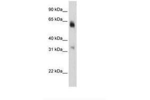 Image no. 3 for anti-Lysine (K)-Specific Demethylase 4D (KDM4D) (C-Term) antibody (ABIN6736292) (JMJD2D anticorps  (C-Term))
