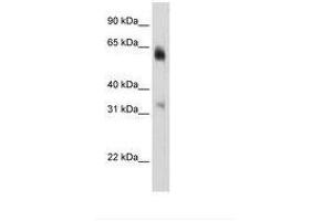 Image no. 3 for anti-Lysine (K)-Specific Demethylase 4D (KDM4D) (C-Term) antibody (ABIN6736292)