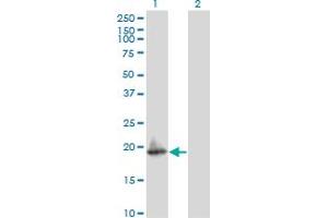 Western Blot analysis of ARF5 expression in transfected 293T cell line by ARF5 monoclonal antibody (M02), clone 1B6. (ARF5 anticorps  (AA 81-180))