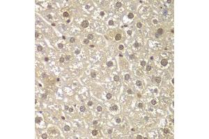 Immunohistochemistry of paraffin-embedded mouse liver using MAD1L1 antibody (ABIN5970500) at dilution of 1/100 (40x lens). (MAD1L1 anticorps)