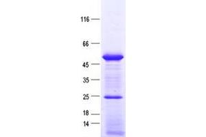 Validation with Western Blot