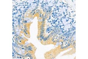 Immunohistochemistry of paraffin embedded rat colon using ATP1HC1 (ABIN7073160) at dilution of 1:500 (400x lens)