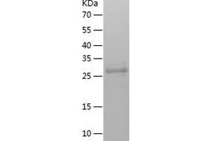 Western Blotting (WB) image for Transmembrane Protein with EGF-Like and Two Follistatin-Like Domains 1 (TMEFF1) (AA 40-330) protein (His-IF2DI Tag) (ABIN7125485)