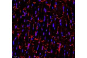 Immunofluorescence of paraffin embedded rat heart using CDH19 (ABIN7073258) at dilution of 1:500 (400x lens)