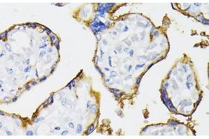 Immunohistochemistry of paraffin-embedded Human placenta using NT5E / CD73 Polyclonal Antibody at dilution of 1:200 (40x lens). (CD73 anticorps)