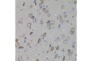 Immunohistochemistry of paraffin-embedded rat brain using UQCRC1 antibody (ABIN5971722) at dilution of 1/100 (40x lens). (UQCRC1 anticorps)