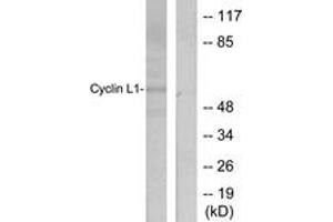 Western blot analysis of extracts from HepG2 cells, using Cyclin L1 Antibody. (Cyclin L1 anticorps  (AA 461-510))