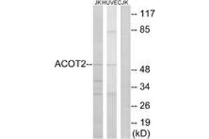 Western blot analysis of extracts from Jurkat/HuvEc cells, using ACOT2 Antibody.