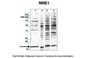 Lanes:  1. (NME1 anticorps  (C-Term))