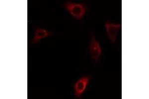 ABIN6275411 staining HepG2 cells by IF/ICC. (PPP1R3C anticorps  (N-Term))