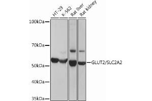 Western blot analysis of extracts of various cell lines, using GLUT2/SLC2 Rabbit mAb (ABIN7270414) at 1:3000 dilution.