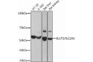 Western blot analysis of extracts of various cell lines, using GLUT2/SLC2 Rabbit mAb (ABIN7270414) at 1:3000 dilution. (SLC2A2 anticorps)
