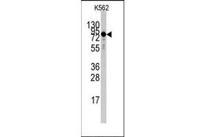 Image no. 1 for anti-Transglutaminase 2 (C Polypeptide, Protein-Glutamine-gamma-Glutamyltransferase) (TGM2) (Middle Region) antibody (ABIN360169) (Transglutaminase 2 anticorps  (Middle Region))