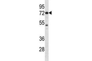 Pak4 antibody western blot analysis in mouse Neuro-2a lysate (PAK4 anticorps  (AA 187-216))