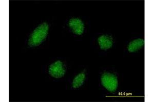 Immunofluorescence of purified MaxPab antibody to TRIM45 on HeLa cell. (TRIM45 anticorps  (AA 1-562))