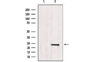 Western blot analysis of extracts from 293, using SM22 aphla Antibody.