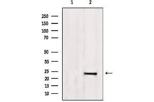 Western blot analysis of extracts from 293, using SM22 aphla Antibody. (Transgelin anticorps  (C-Term))