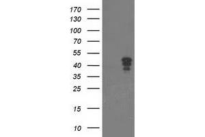Western Blotting (WB) image for anti-Nudix (Nucleoside Diphosphate Linked Moiety X)-Type Motif 9 (NUDT9) antibody (ABIN1499876) (NUDT9 anticorps)