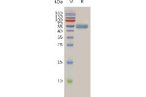 Human Protein, mFc Tag on SDS-PAGE under reducing condition.