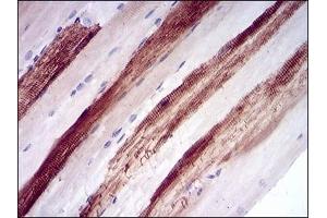 Immunohistochemical analysis of paraffin-embedded human muscle tissues using MB mouse mAb with DAB staining.