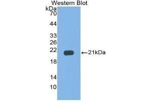 Western blot analysis of the recombinant protein. (IL17C anticorps  (AA 7-159))
