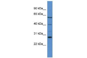 WB Suggested Anti-CYP24A1 Antibody Titration: 0. (CYP24A1 anticorps  (C-Term))