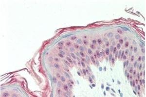 Human, Skin: Formalin-Fixed Paraffin-Embedded (FFPE)