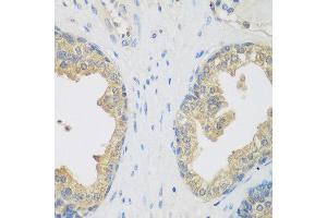Immunohistochemistry of paraffin-embedded human prostate using ENPEP antibody at dilution of 1:200 (40x lens). (ENPEP anticorps)