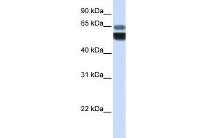 WB Suggested Anti-SMPD1 Antibody Titration:  0. (SMPD1 anticorps  (Middle Region))