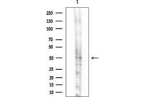 anti-Histamine Receptor H2 (HRH2) (Internal Region) antibody