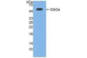 Detection of Recombinant EP3, Human using Polyclonal Antibody to Prostaglandin E Receptor 3 (EP3)